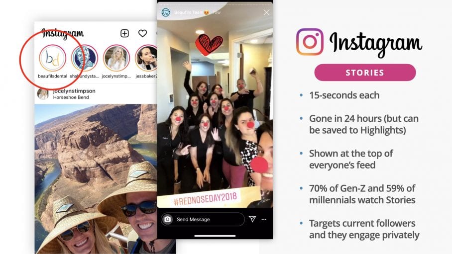 instagram dental stories